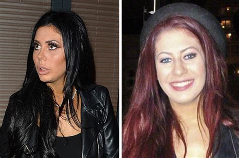 chloe ferry surgery|geordie shore plastic surgery.